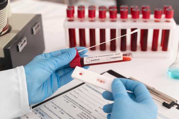 Анализ крови: что раскрывают результаты среднего объема передачи эритроцитов