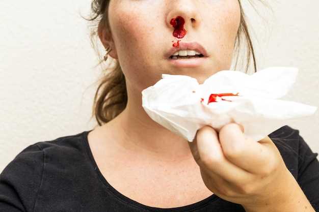 Чем остановить кровотечение из носа