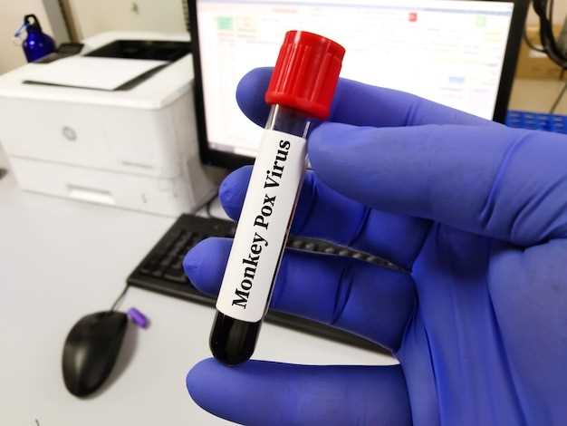 Через какое время после заражения гепатитом С можно обнаружить его вирус в крови