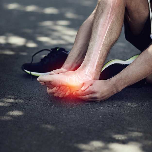 Основные симптомы боли в связках на ноге