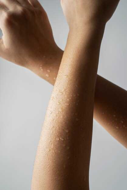 Как бороться с очень сухой кожей всего тела: простые советы и эффективные методы