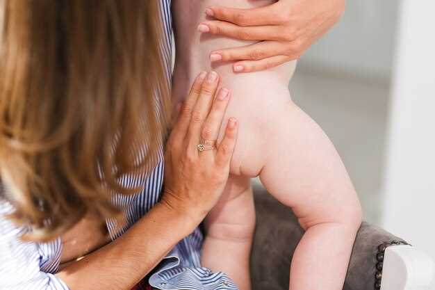 Лечение атопического дерматита у ребенка: современные методы