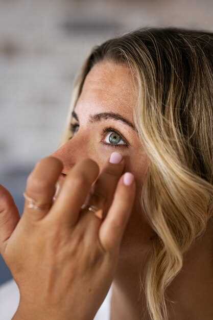Профессиональные методы лечения синяков под глазами у женщин
