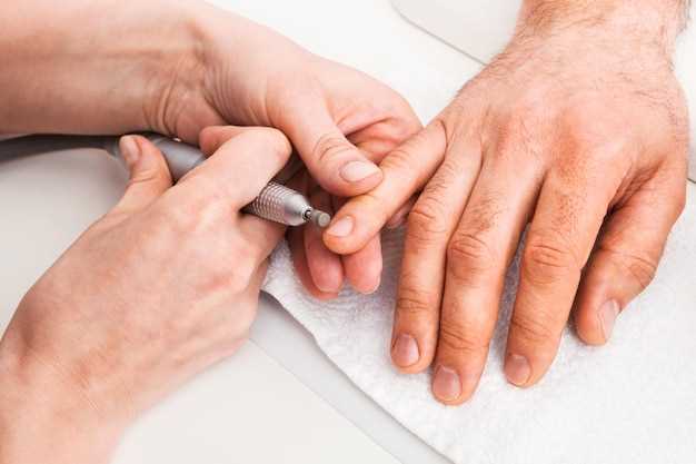 Как определить заболевание ногтей?
