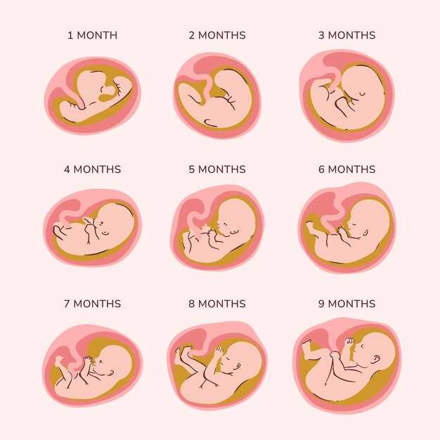 Как отличить симптомы желтушки у новорожденных