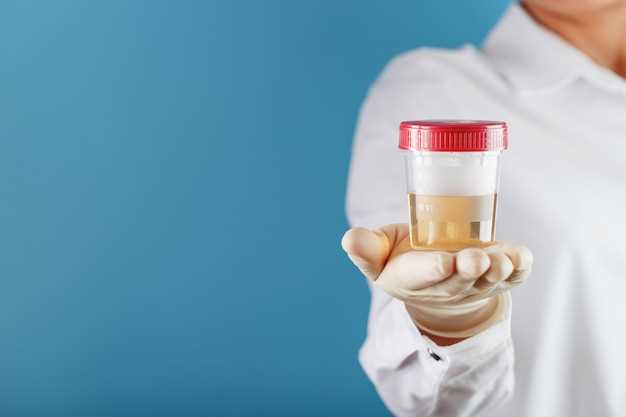 Как правильно готовиться к анализу на мочевую кислоту?