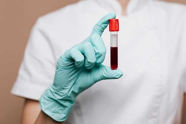 Как сдать кровь на сифилис: подробная инструкция