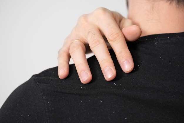 Как выглядит псориаз на пальцах рук: основные признаки и симптомы