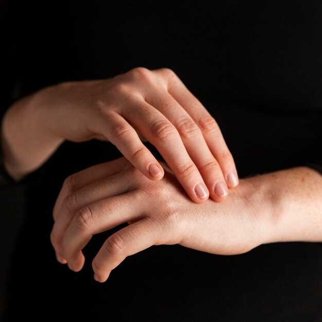Псориаз на пальцах рук: основные признаки и симптомы
