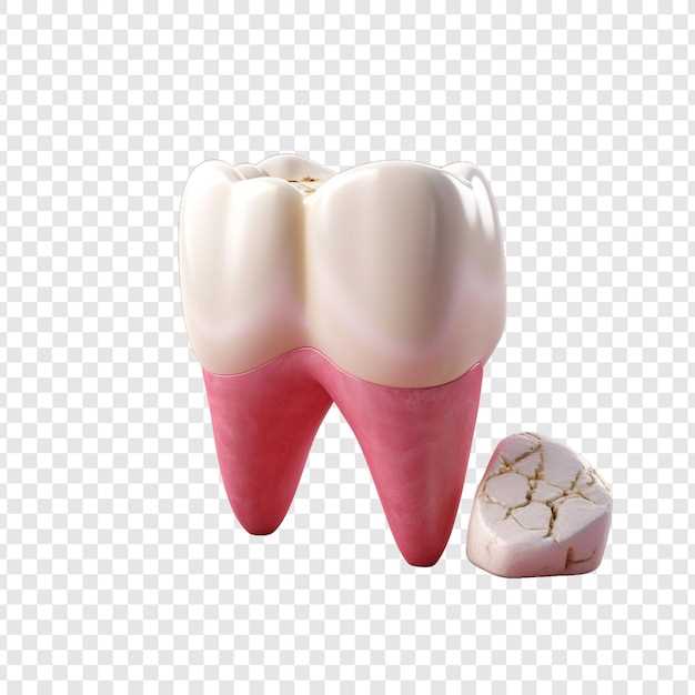 Кариес внутри зуба: симптомы, причины и лечение