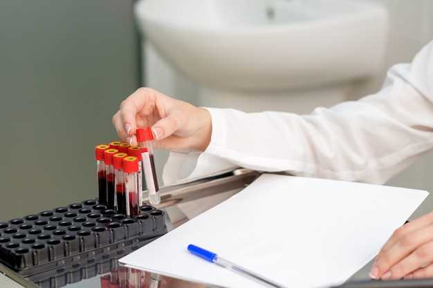 Основные причины повторного анализа крови и возможные последствия игнорирования