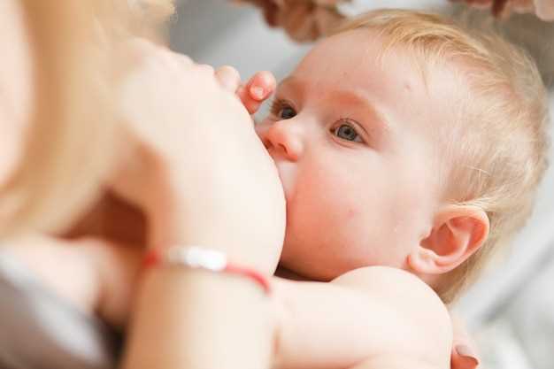 Почему у новорожденного появляются красные пятна на лице и как с ними бороться