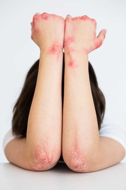Какие симптомы сопровождают красное шершавое пятно на руке?