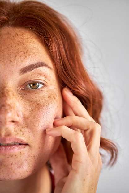 Здоровье кожи лица