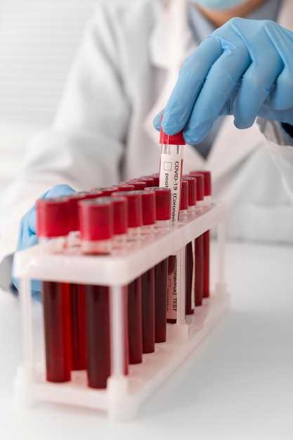 Кровь на гормоны: какие анализы сдать