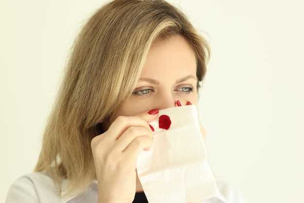 Причины кровотечения из носа и способы их предотвращения