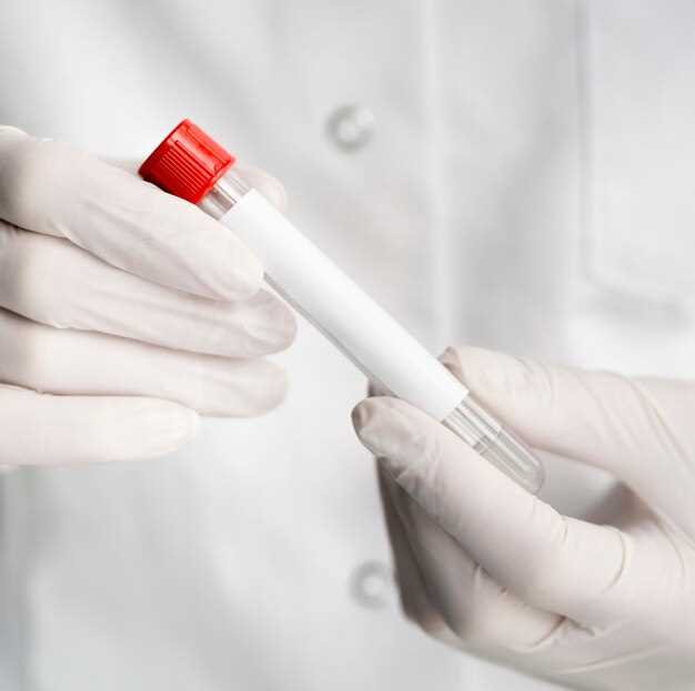 Что такое моноциты и зачем нужен анализ крови?