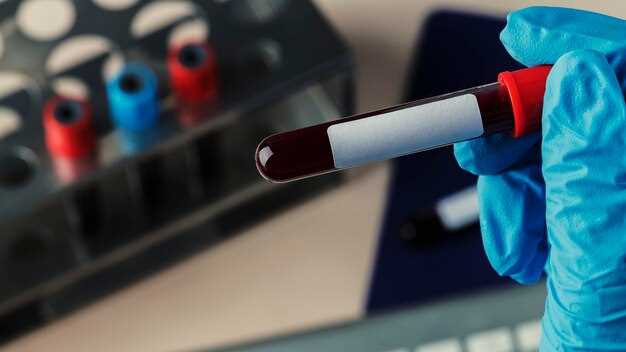 Миф или реальность: можно ли определить рак по общему анализу крови?
