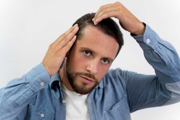 Способы предотвращения и лечения выпадения волос у мужчин