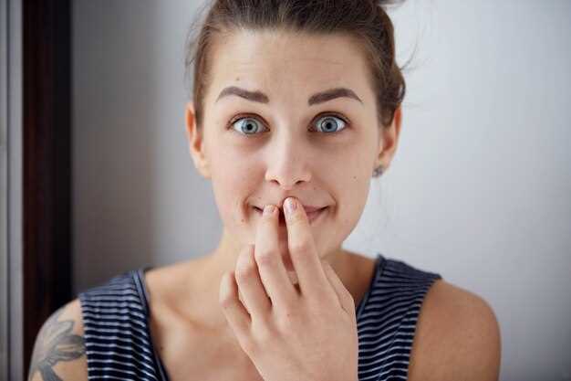 О причинах и лечении прыщей на щеках у женщин