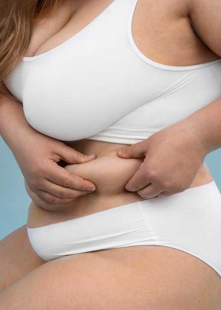 Ожирение 3 степени у женщин: эффективное лечение и снижение веса