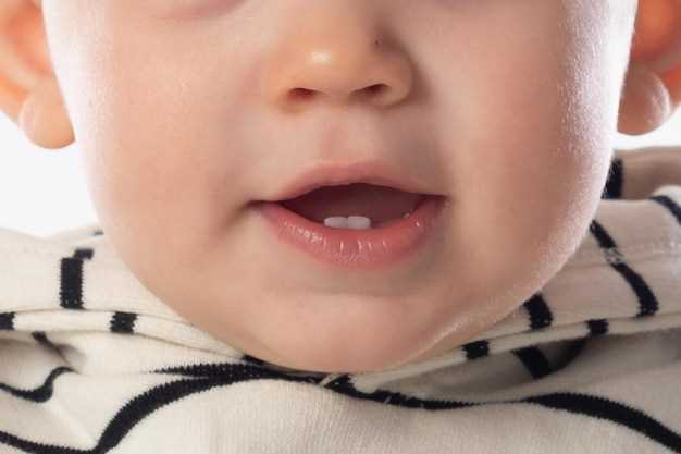 Лечение трескания уголков губ у ребенка