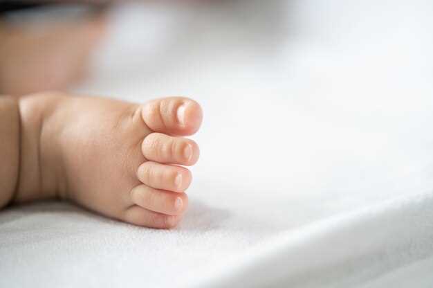Почему у младенца синеют ручки и ножки: причины и рекомендации