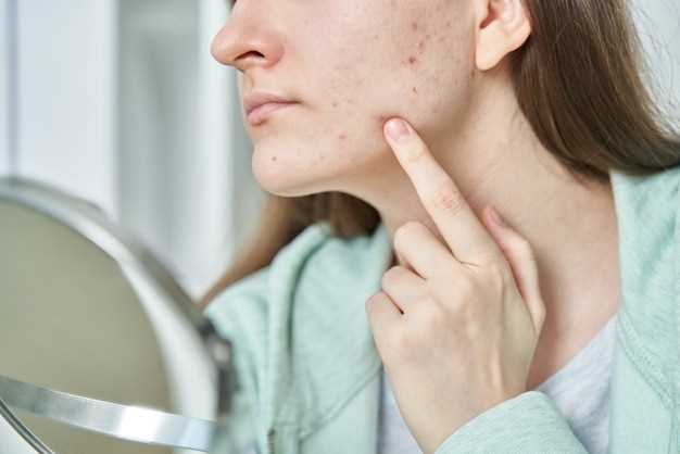 Подкожный клещ на лице: симптомы, внешний вид, лечение