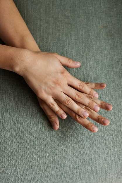 Пожелтели ногти на руках: причины и способы лечения
