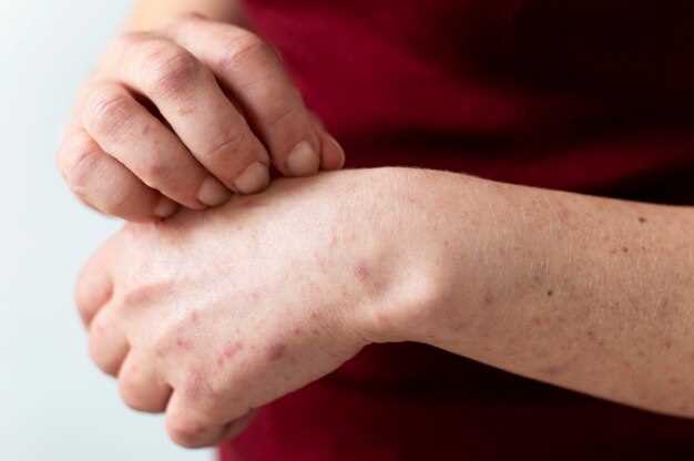 Причины и способы лечения треснувшей кожи на руках