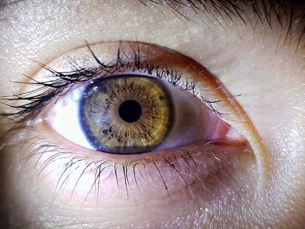 Причины, симптомы и лечение болезни с глазами разного цвета