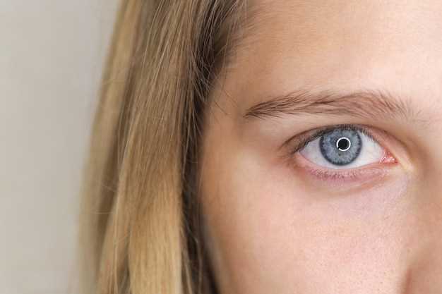 Заболевания и инфекции, аномалии в структуре глаза, воспалительные процессы