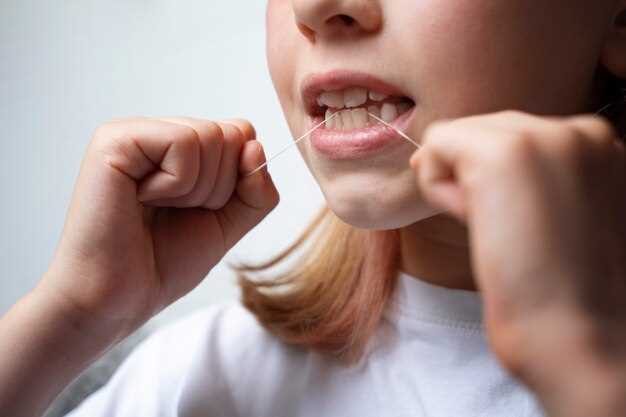 Сколько чистить зубы, чтобы предотвратить появление кариеса?