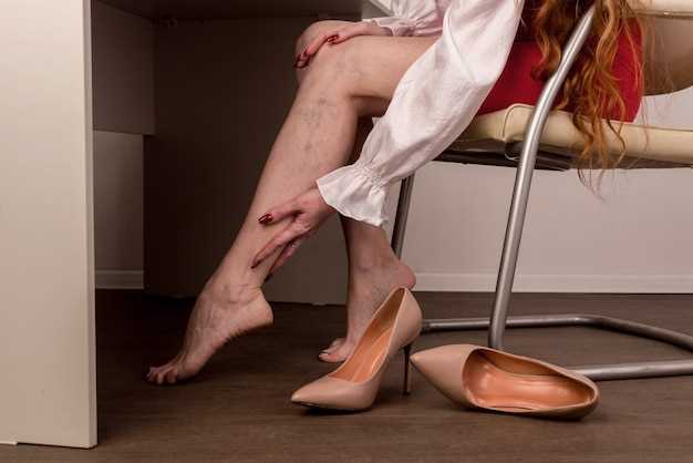 Варикоз на ногах у женщин: причины и факторы возникновения