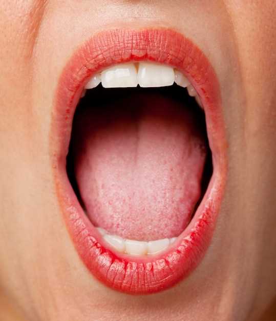 Причины язвочки на губе